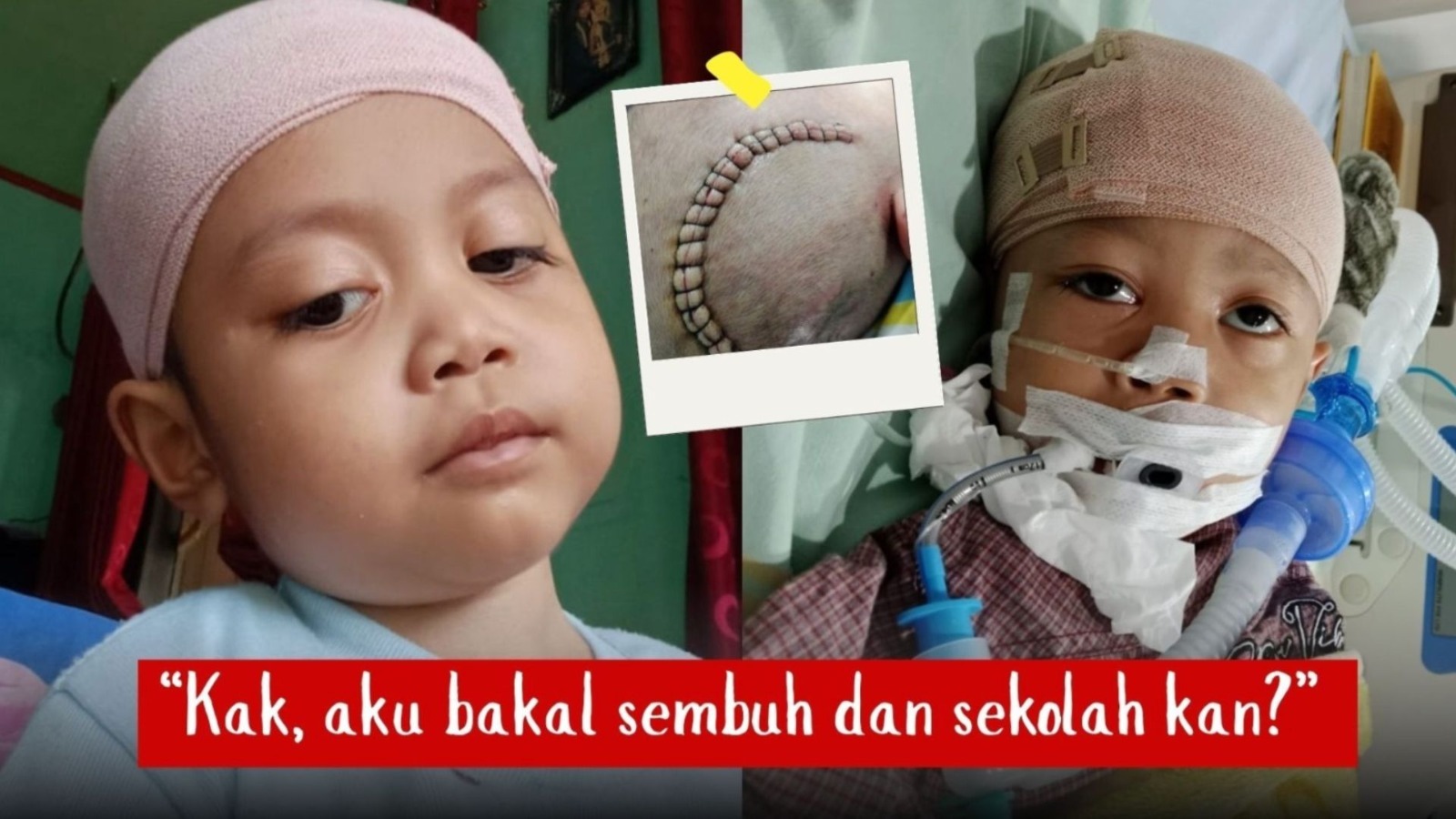Bantu Alfarenzi Lawan 5 Penyakit Berat - 22040