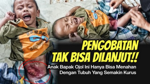 Lahir Tanpa Anus Bantu Anak Ojol Ini Bisa Lakukan Peng