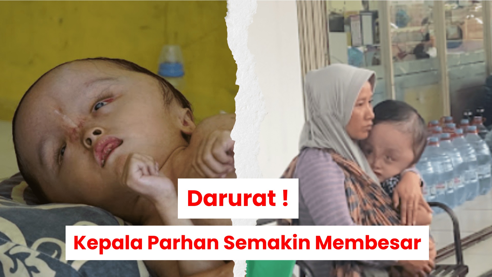 Bantu Parhan Tetap Bertahan - 21074