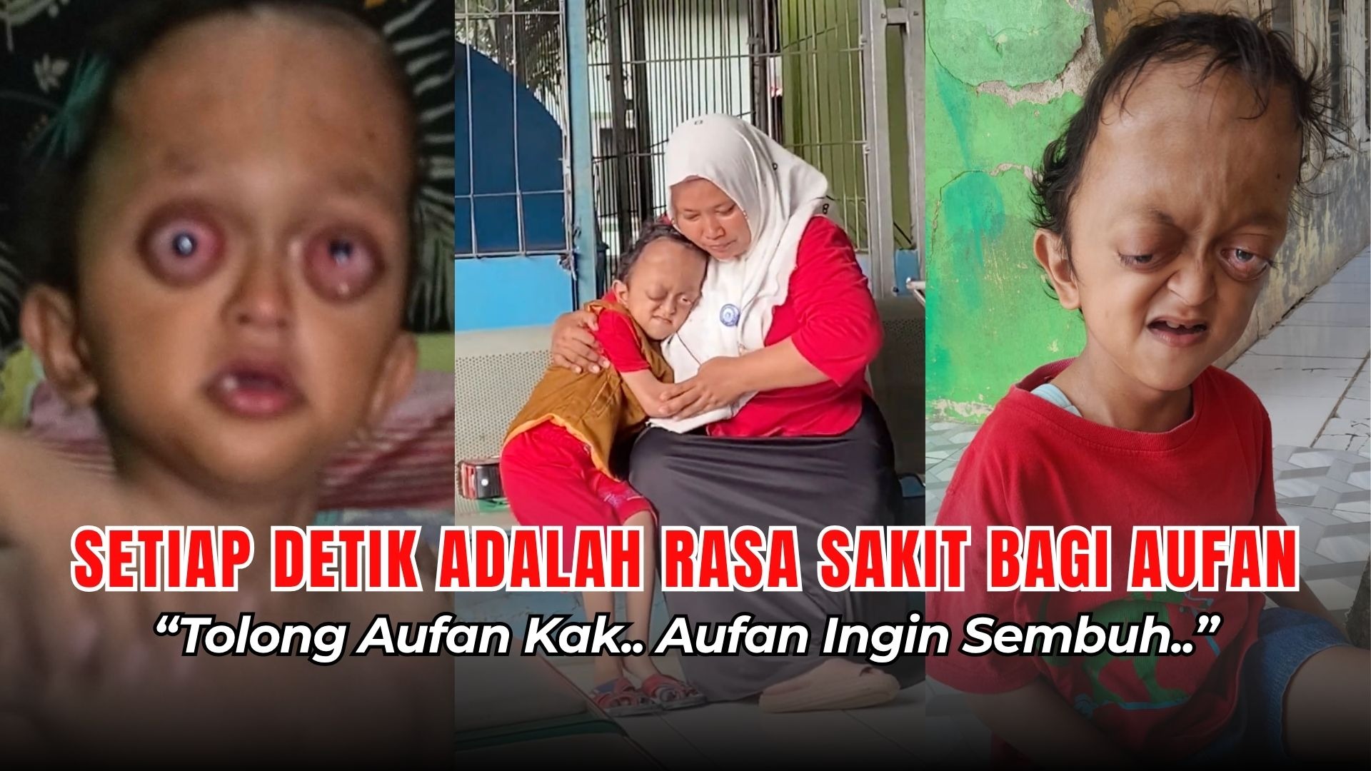 Tolong! Anak Guru Honorer Lawan 3 Penyakit Langka - 22272