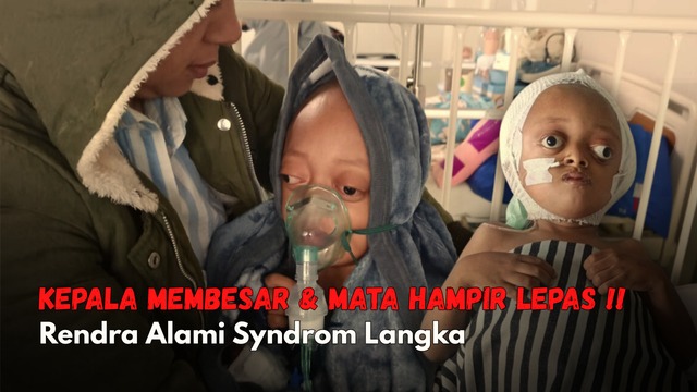 Idap Penyakit Langka Rendra Butuh Biaya Untuk Operasi