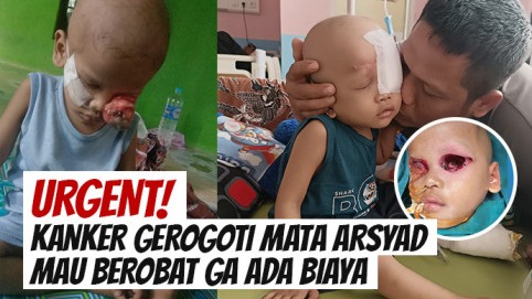 Tolong! Bantu Anak 3 Tahun Ini Sembuh Dari Kanker Mata - 22264
