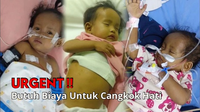 Butuh Biaya Tuk Operasi Cangkok Hati