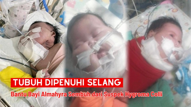 URGENT Bantu Bayi Almahyra Berjuang di NICU