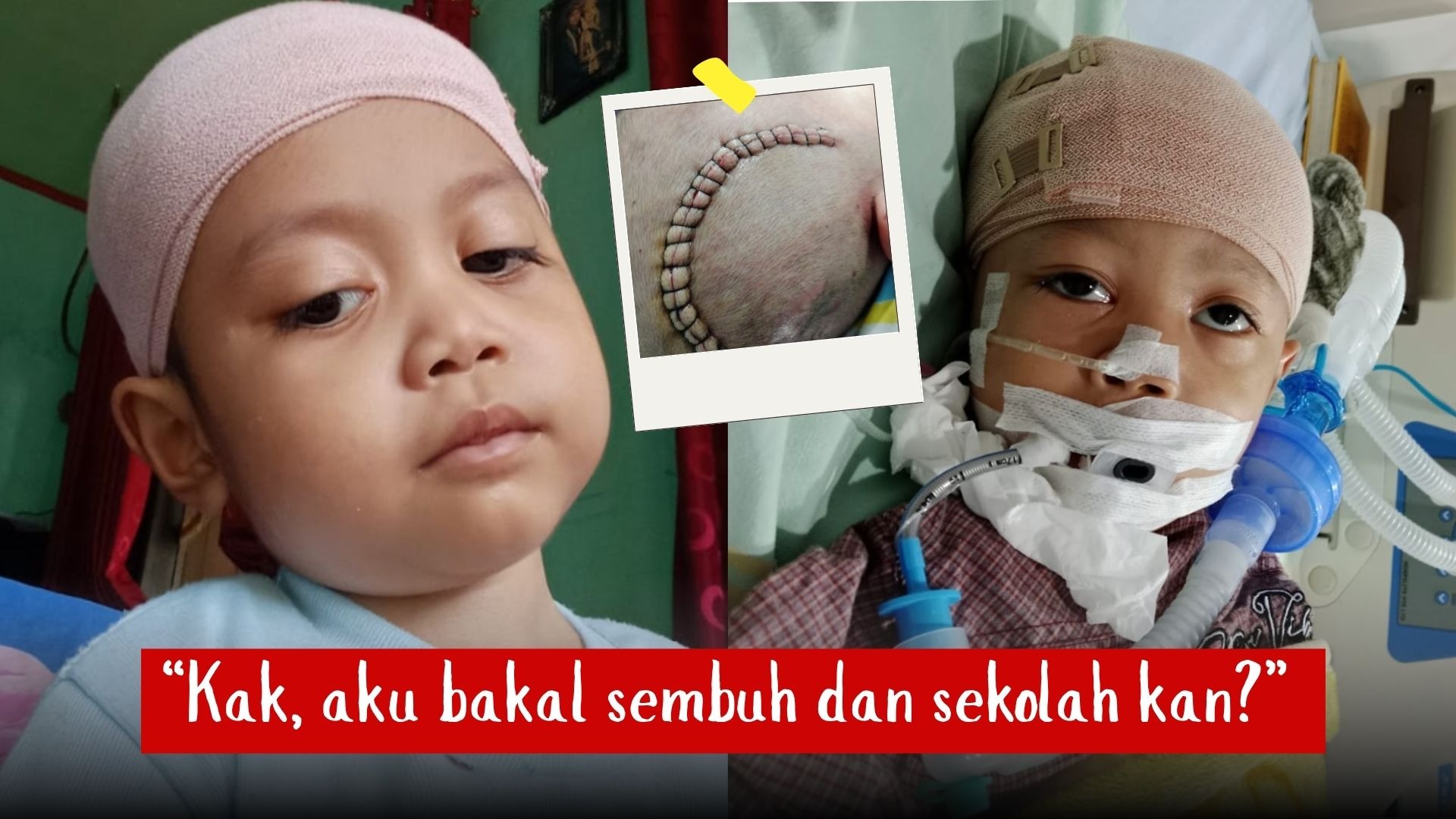 Bantu Alfarenzi Lawan 5 Penyakit Berat - 20807