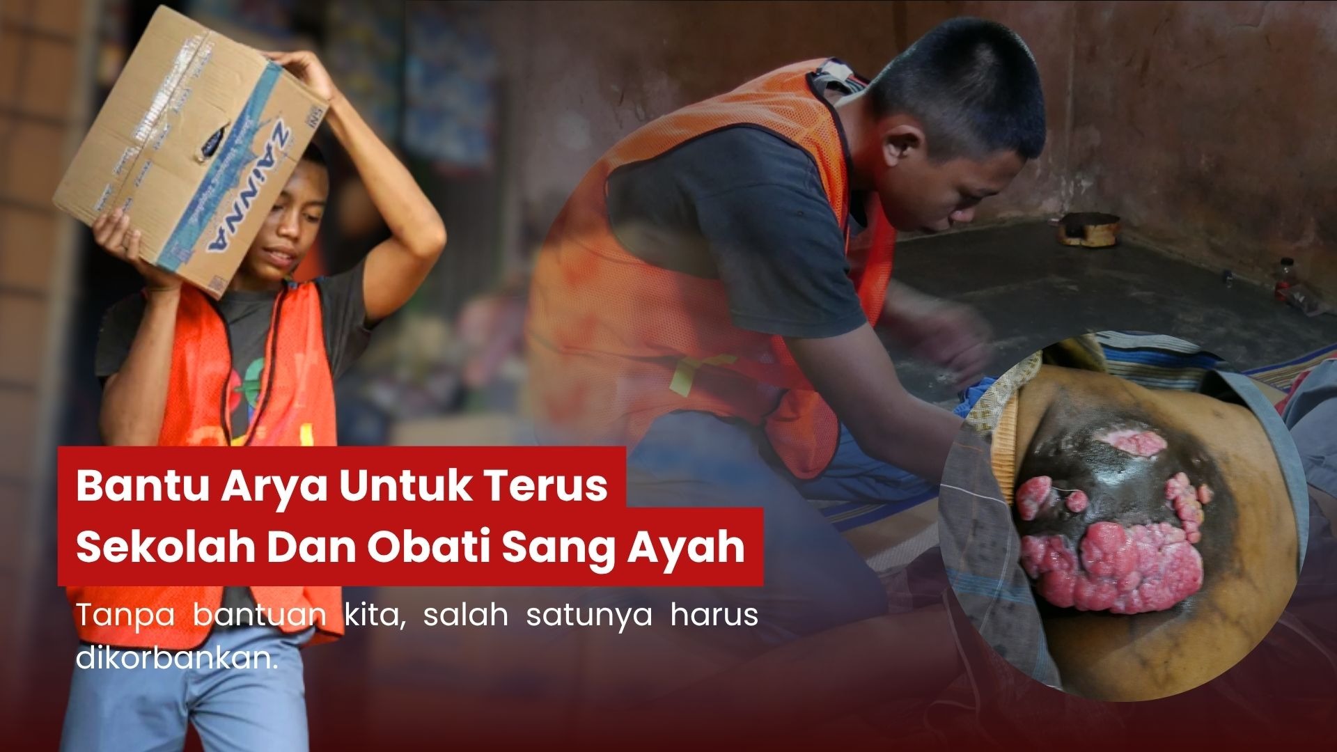 Bantu Arya Untuk Terus Sekolah Dan Obati Sang Ayah - 22069