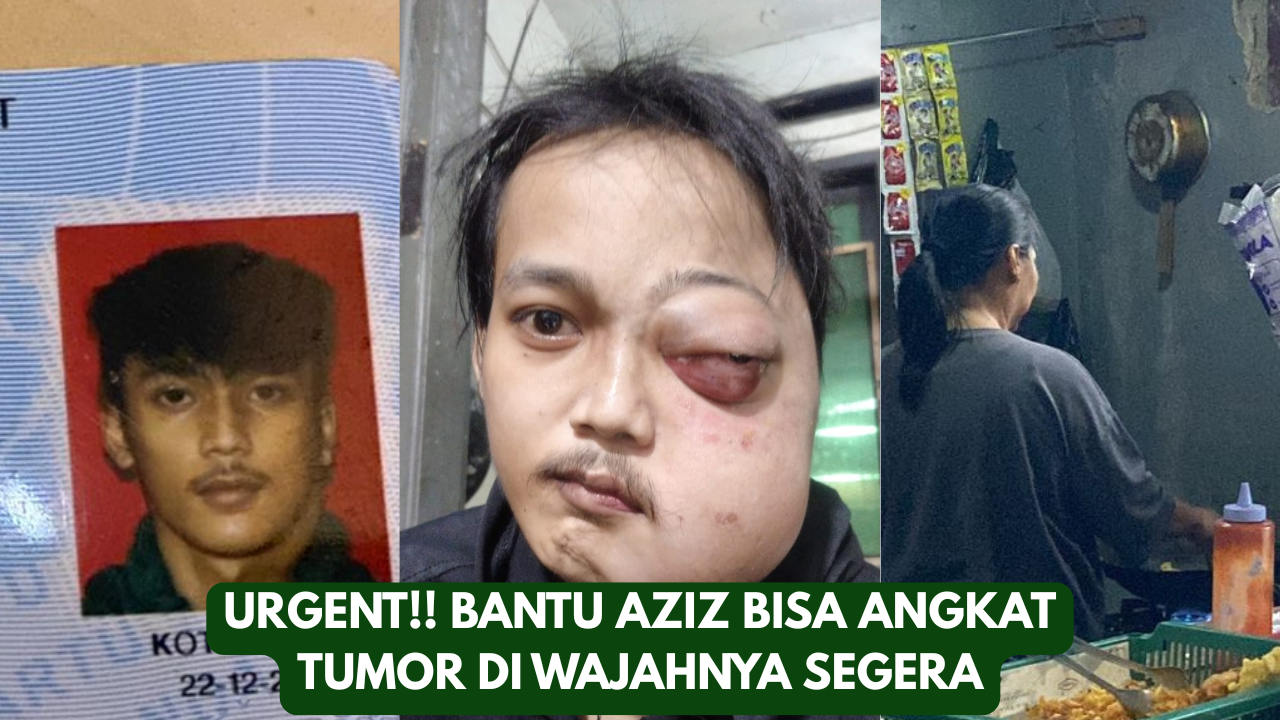 Bantu Azis bisa Angkat Tumor Wajah - 18703