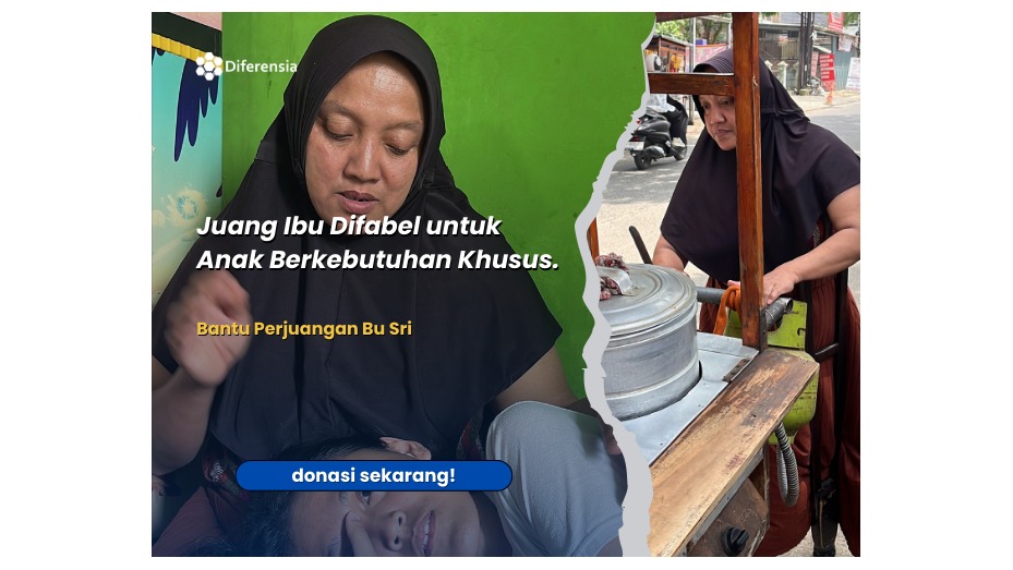 Satu Kaki Penopang Harapan Perjuangan Hebat Bu Sri