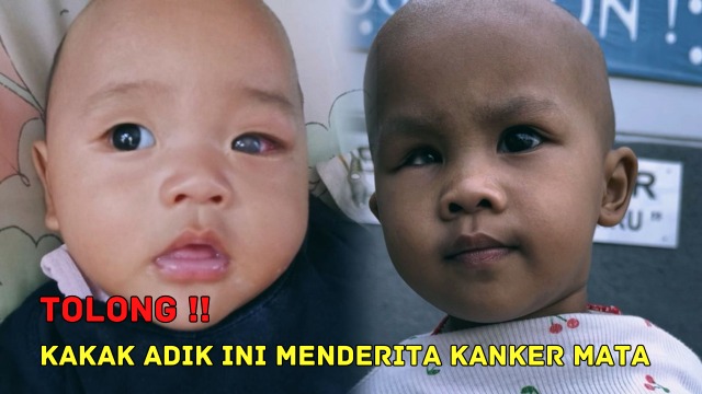Bantu Perjuangan Kakak Adik Lawan Ganasnya Kanker Mata - 19600