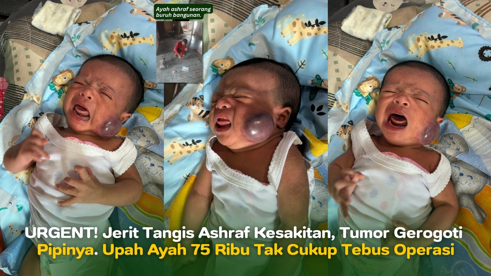 Tumor Gerogoti Pipi Ashraf Bantu Ashraf Sembuh