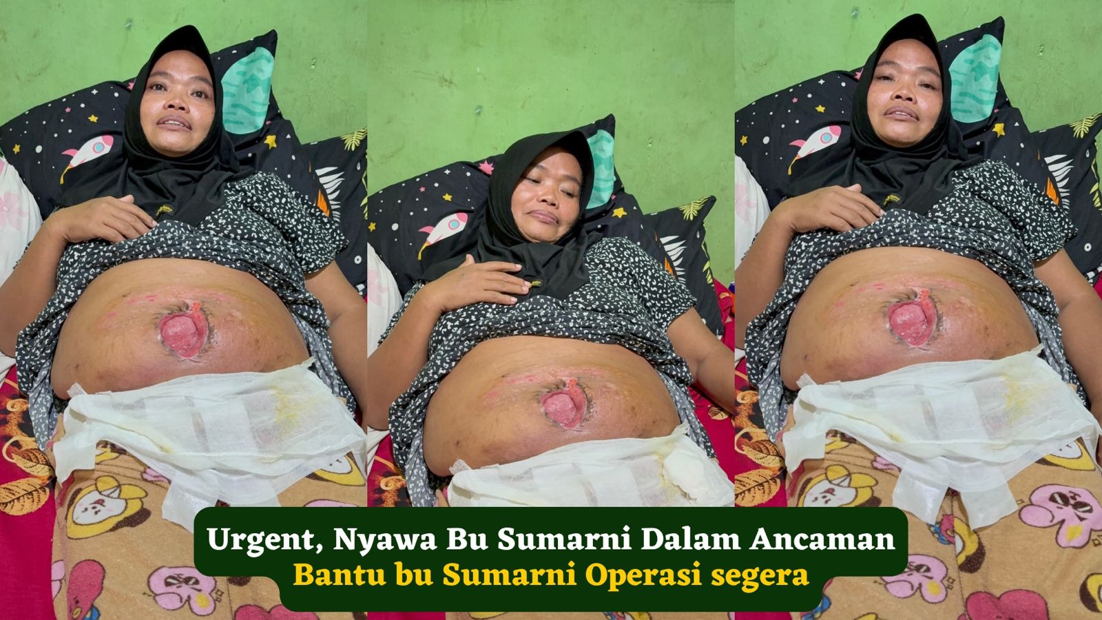 Nyawa Bu Sumarni Dalam Ancaman Bantu bu Sumarni Operasi - 21714