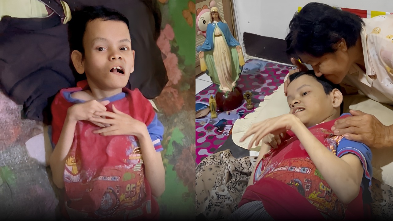 Tuhan Yesus Tolong Sun Dapat Terapi Kembali - 20706