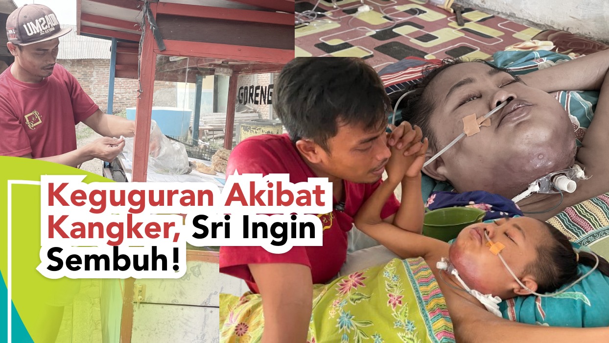 Keguguran Akibat Kanker Sri Ingin Sembuh - 22481