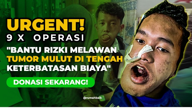 Rizki Dibuli Karena Tumor di Mulut, Bantu Operasi Segera - 19117