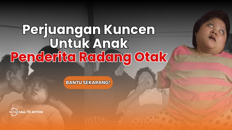 Tolong Abah Kuncen Sembuhkan Anak Radang Otak - 19518