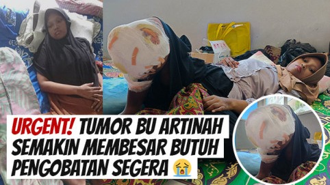 Idap Tumor Kaki Bantu Bu Artinah Bisa Berobat
