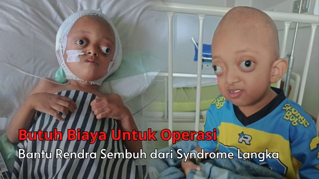 Idap Penyakit Langka! Rendra Butuh Biaya Untuk Operasi - 22906