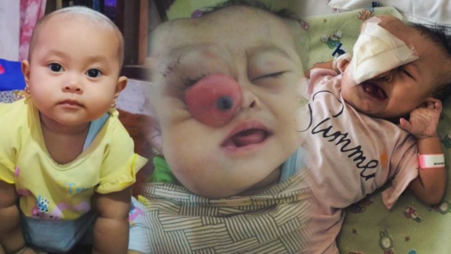 Jerit Kesakitan Aleeza Bola Mata Nyaris Keluar