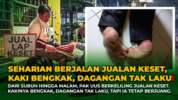 Kaki Bengkak Melepuh Dagangan Juga Tak Laku Seharian - 20451