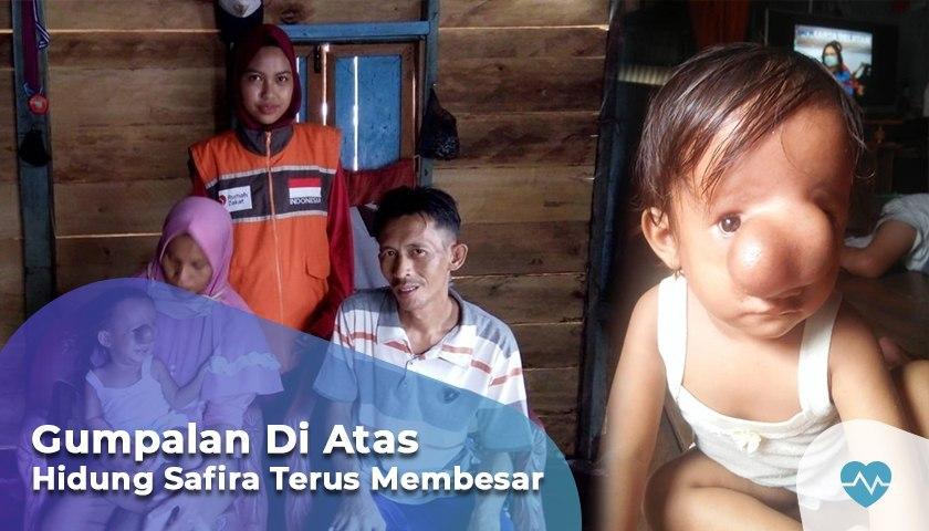 Bantu Safira Operasi Kanker di Hidung - 7292
