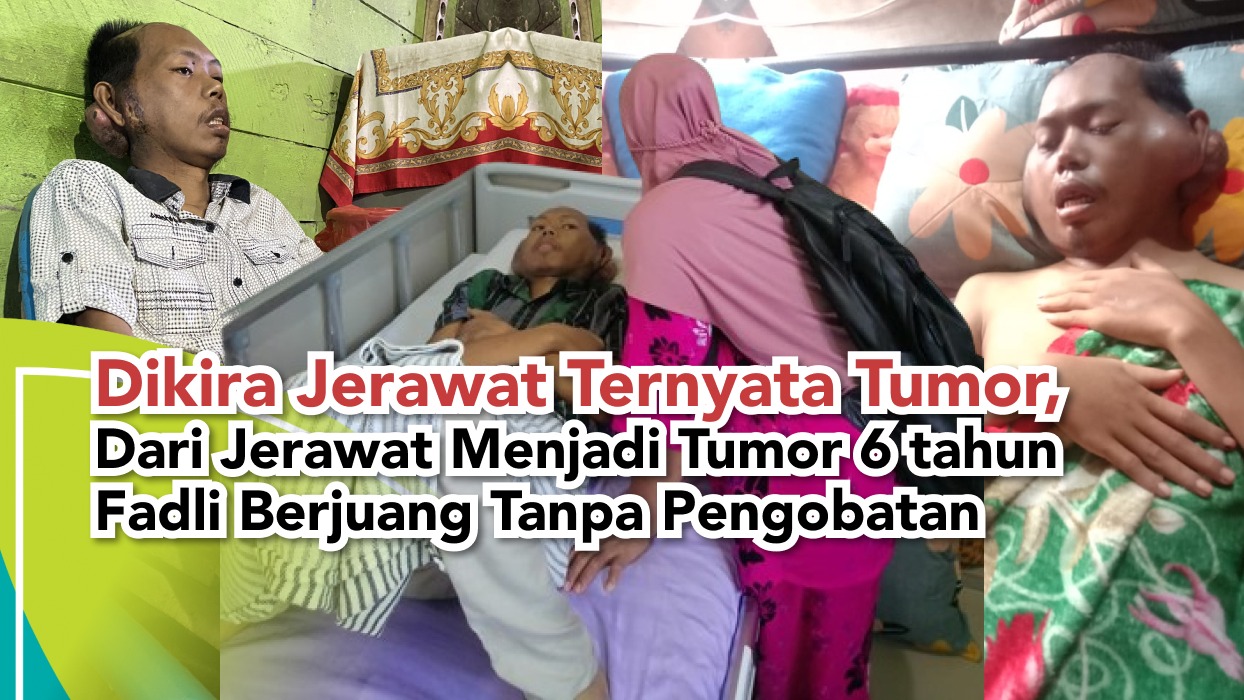 6 Tahun Berjuang Tanpa Pengobatan! BANTU FADLI SEKARANG - 22486