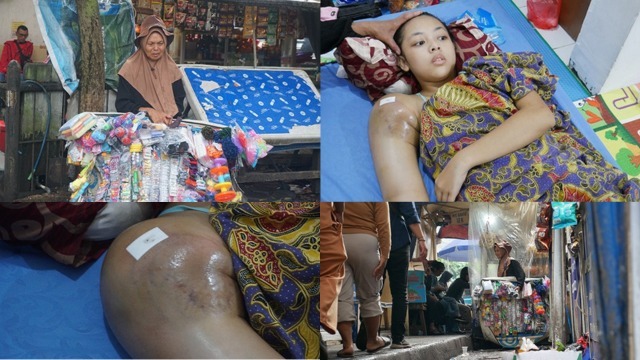 Doa Dan Perjuangan Sang Ibu Untuk Kesembuhan Putrinya - 23444