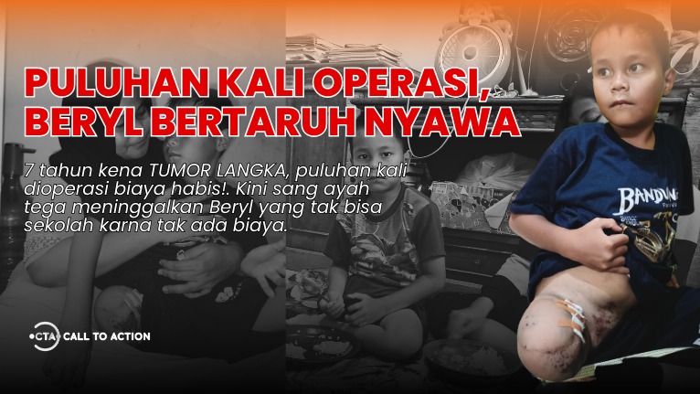 TOLONG! Kaki Beryl Buntung Karna TUMOR GANAS - 21020