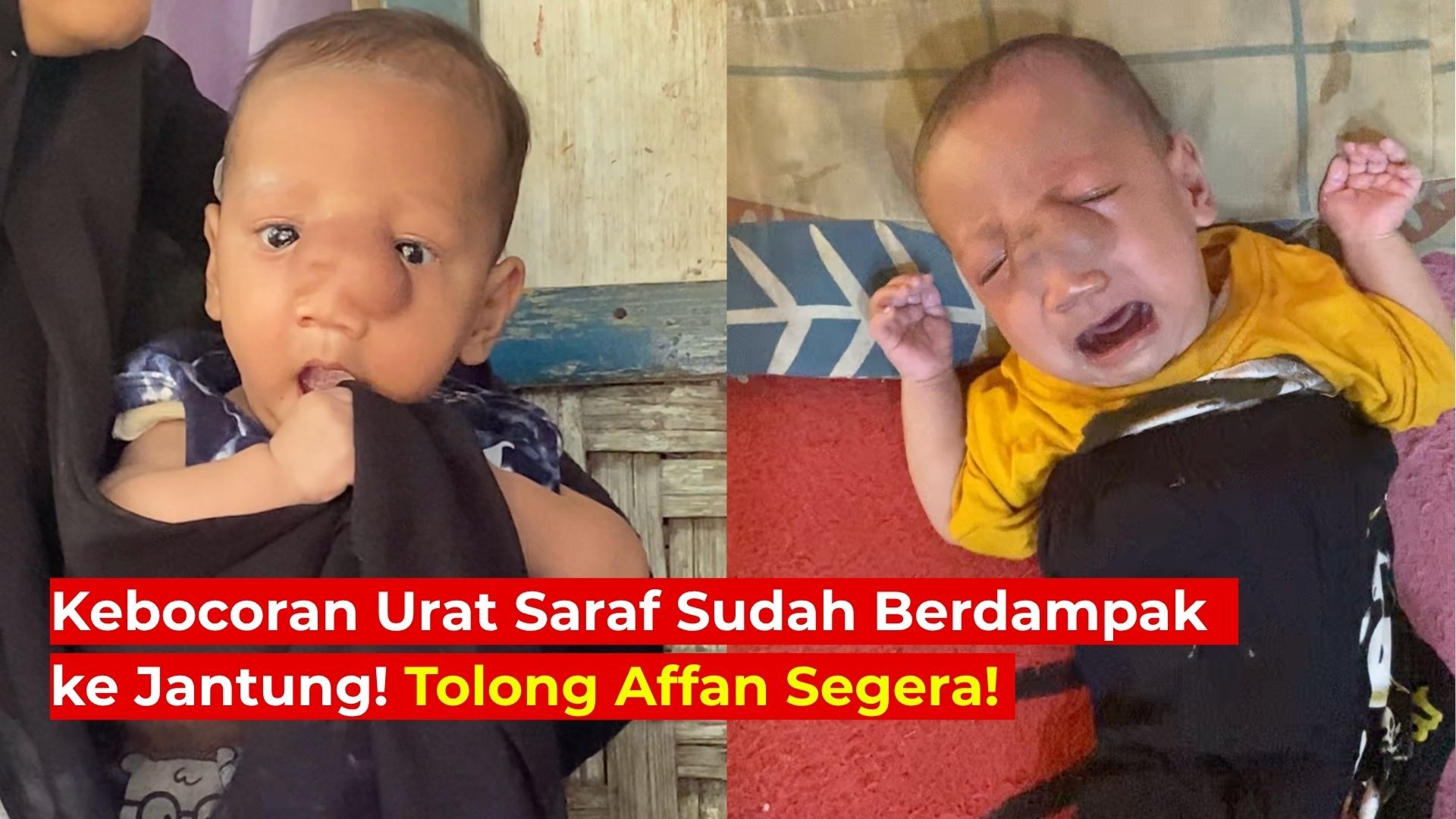 Tolong Affan Operasi Ke-2 Sebelum Penyakit Ambil Nyawa! - 21391