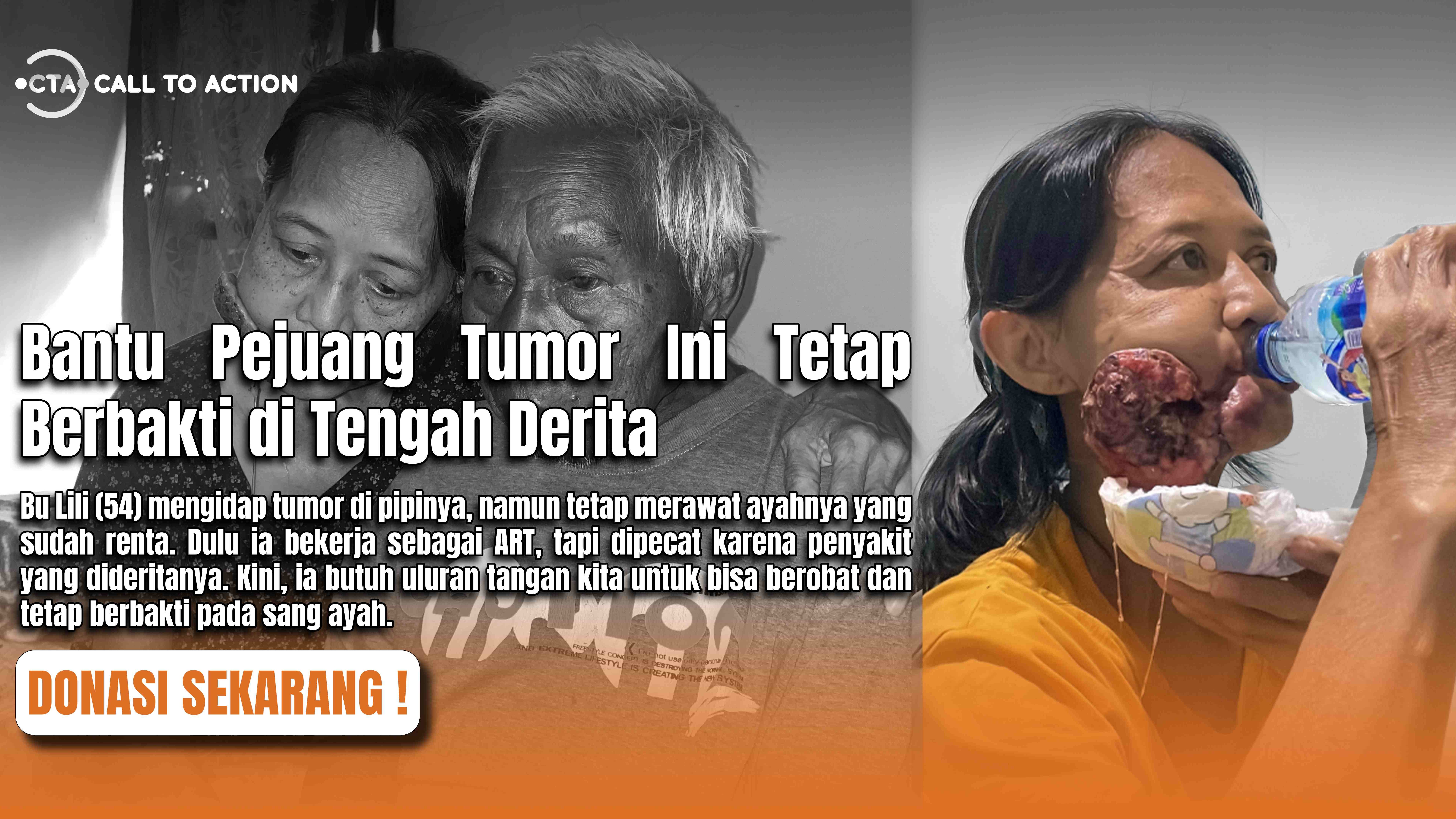 Selamatkan Bu Lili Dari Tumor Ganas Di Pipinya - 21604