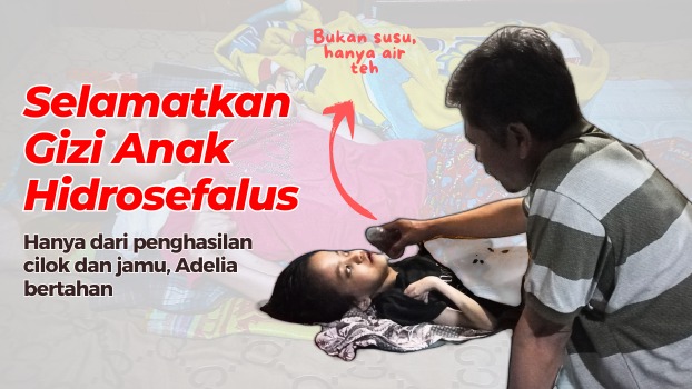 Bantu Pak Sutiman Rawat Anaknya yang Idap Hidrosefalus - 22384