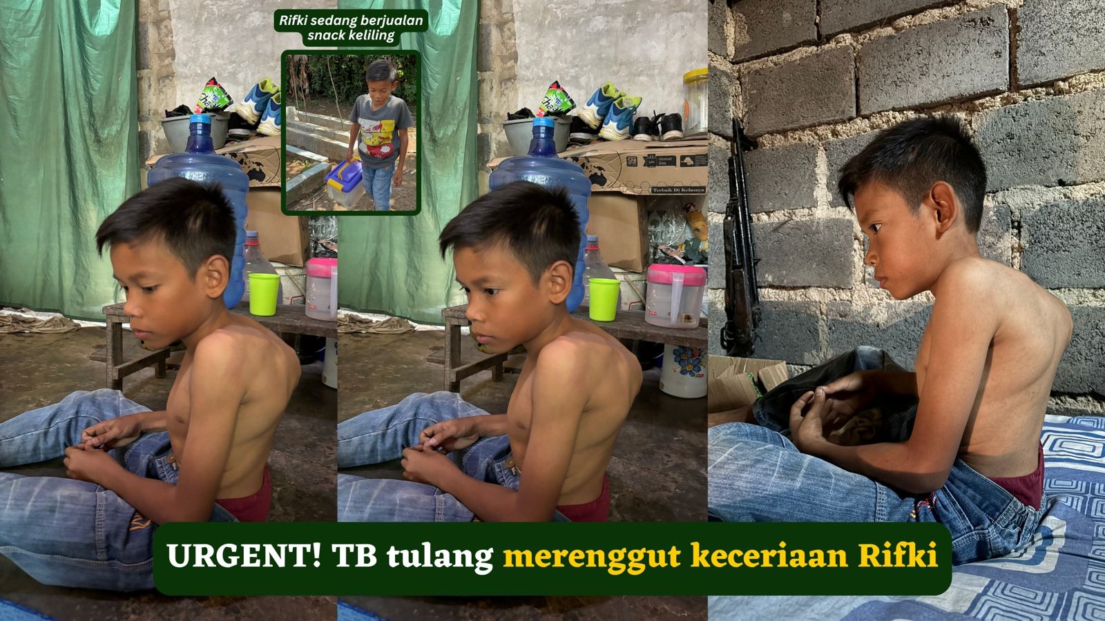 URGENT! TB tulang merenggut keceriaan Rifki - 23077