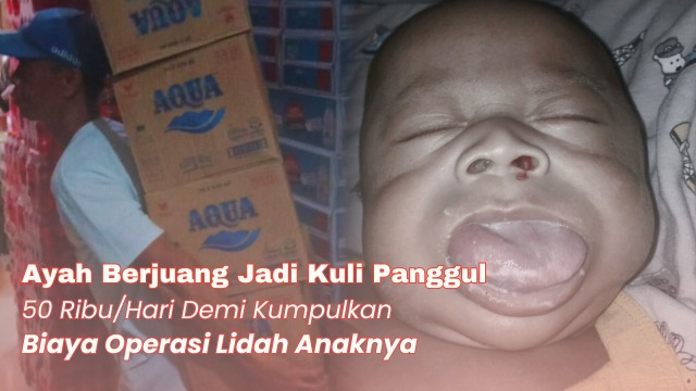 Anak Kuli Panggul Berjuang Sembuh dari Syndrome Langkah - 19861