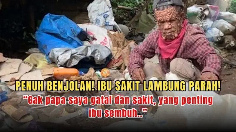 Penuh Benjolan! Bantu Bapak Rongsok Sembuhkan Ibunya