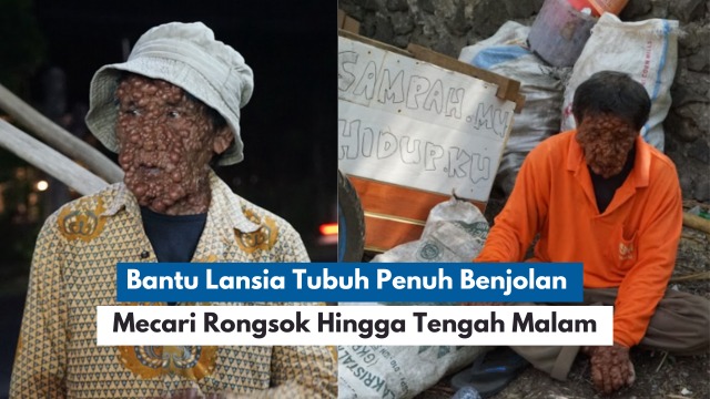 Bantu Lansia Penuh Benjolan yang Merongsok Tengah Malam - 20884