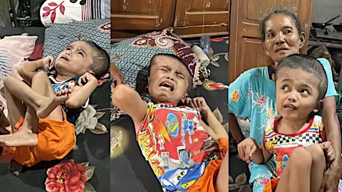 bantu bu warsini rawat anaknya - 22808