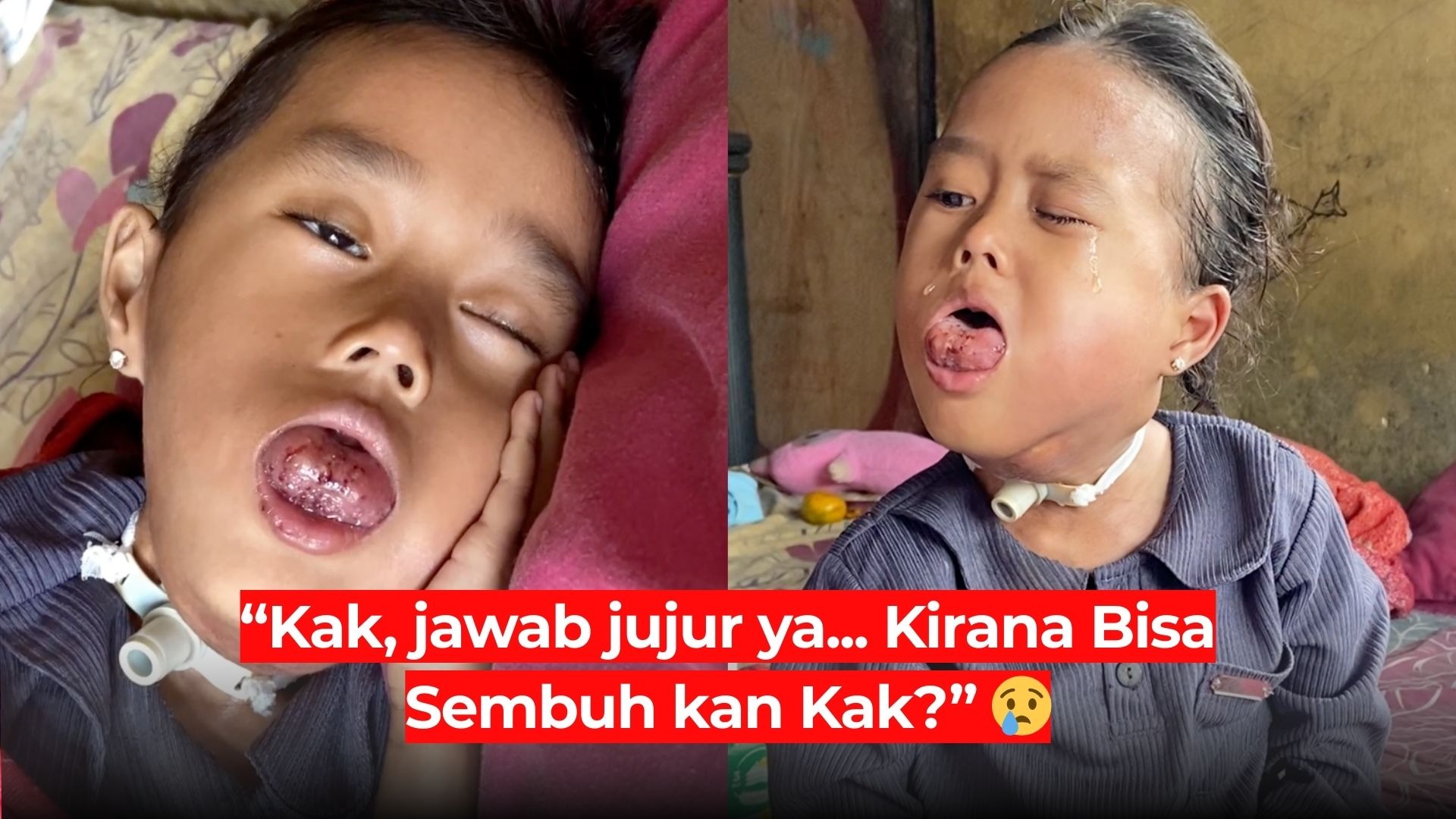 Kirana Kritis! Butuh Biaya Operasi Segera - 21900