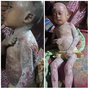 kondisi gito kondisi gito